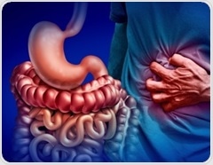 Can diet ease IBS? A low-FODMAP plan cut symptoms but raised nutrient concerns