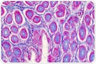Addressing Protein Leakage in Cells to Improve the Accuracy of Single-Cell Proteomic Data