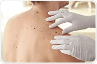 Study reveals how PAX3 protein drives melanoma growth