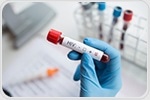 HIV uses circular RNAs to evade immunity and boost replication