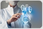 Cell Painting technology uncovers flavonoids with potential to treat bladder cancer