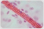 Innovative technology offers non-invasive way to observe blood clotting