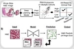 AI Predicts Kidney Cancer Drug Response Using Routine Pathology Slides