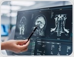 How innovation in dried blood spot testing is transforming neurological disease monitoring