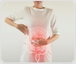 Upper gastrointestinal involvement is common in Egyptian patients with ulcerative colitis