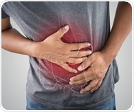 Upper gastrointestinal involvement is common in Egyptian patients with ulcerative colitis