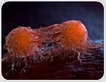 Early camizestrant therapy keeps advanced breast cancer in check