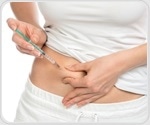 Study explores the connection between abnormal uterine bleeding and hyperinsulinemia