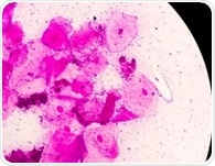 Glycan mapping reveals what keeps the vaginal microbiome healthy