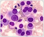 Universal CAR T cell therapy shows promise for aggressive T cell cancers