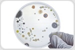 Lab Perturbations Disrupt Cross-Feeding, Leading to Microbial Extinction