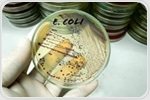 Identifying Key Genetic Elements for Plasmid Curing in E. coli