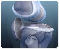 New meta-analysis highlights effective non-drug therapies for knee osteoarthritis