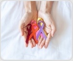 New molecular imaging agent shows high accuracy in detecting liver cancer
