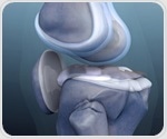 New meta-analysis highlights effective non-drug therapies for knee osteoarthritis