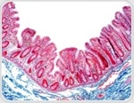 Organotypic model of the human gut epithelium demonstrates genetic determinants of Shigella colonization