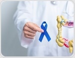 Do genetic variants that affect DNA methylation influence colorectal cancer risk or outcomes?