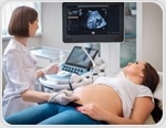 Genes may determine how early life exposures shape the gut microbiome