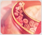 New enzyme can be "turned off" to restore cholesterol balance and reduce inflammation