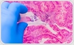 LOCA-PRAM: AI-Driven Biosensing Offers Real-Time, Point-of-Care Diagnostics