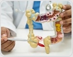 Appendix cancer on the rise: Implications for diagnosis and patient care