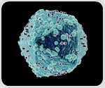 Beetle-inspired tuberculosis testing device offers accurate detection for people with HIV