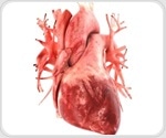 New PET/CT imaging technique enables early detection of multiple forms of cardiomyopathy