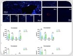 The impact of PD-1-positive immune cell ratios and TLS on gastric cancer treatment response