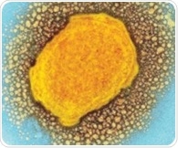 Blood viral load predicts severity of mpox symptoms