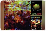 Evidence for Neural Stem Cell-Based Therapies in Multiple Sclerosis