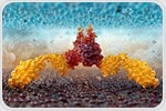 CAR T-cell therapy successfully treats rare autoimmune disease of the peripheral nervous system