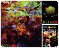 Evidence for neural stem cell-based therapies in multiple sclerosis