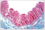 Organotypic Model of the Human Gut Epithelium Demonstrates Genetic Determinants of Shigella Colonization