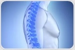 AI system estimates bone density using routine X-ray images