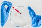 New Microchip Maps Antibody Responses Using Just a Drop of Blood