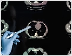 Study reveals pandemic life made brains age faster, even without catching COVID-19