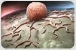 Advanced Genetic Analysis with the epicGEN Solid Cancer and MSI Kit
