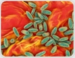 Why Is Plague Still a Threat? Historical Lessons and Future Preparedness