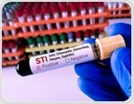 Congenital syphilis remains a threat to healthy births despite screening