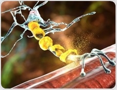 OHSU team identifies gene essential for brain's protective layer