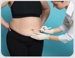 Patients face vitamin deficiencies years after bariatric surgery