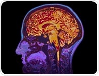 Perceived sickness activates real immune responses