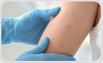 Enhanced skin cancer detection with AI imaging techniques