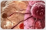 Immunotherapy shows promise in changing leukemia’s cellular environment