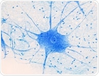Case Western Researchers Use Stem Cells to “Shut Off” Nerve Cell Strain