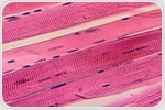 Muscle Reprogramming Protein Found to Both Activate and Repress Genes