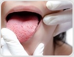 Can oral bacteria make heart disease worse?