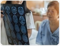 Can the gut microbiome adapt to protect the brain after stroke?