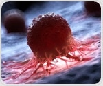 Prostate cancer rates rise as mortality decline slows in the United States