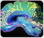 Polβ enzyme found to protect developing brain from harmful DNA mutations